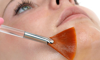 chemical-skin-peel-remove-pigmentation-beautifySA